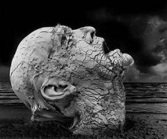 10 Doenças mais estranhas do mundo 